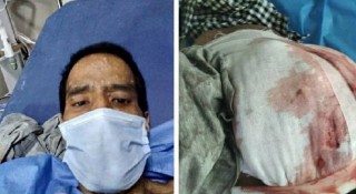 क्यान्सरसँगै कोरोना लागेका नेपालीको चित्कारः भारतको अस्पतालले बस्न दिएन, सरकारले सुनेन