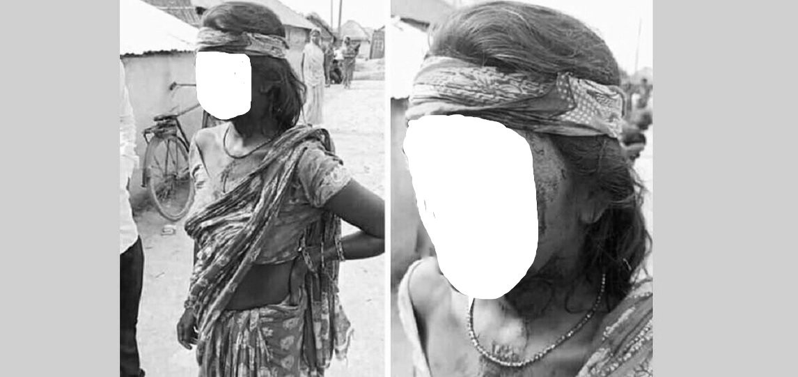 बोक्सीको आरोपमा निर्घात कुटपिट, प्रहरीले उजुरी लिन मानेन