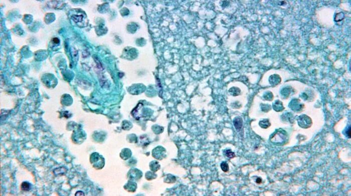 धाराको पानीमा मानिसको गिदी खाने जीवाणु, प्रयोग नगर्न चेतावनी
