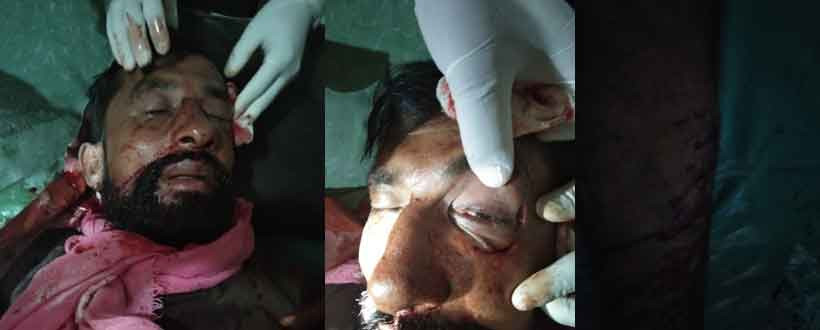 कांग्रेस प्रवेश गरेका दम्पतीमाथि रुकुममा गम्भीर आक्रमण