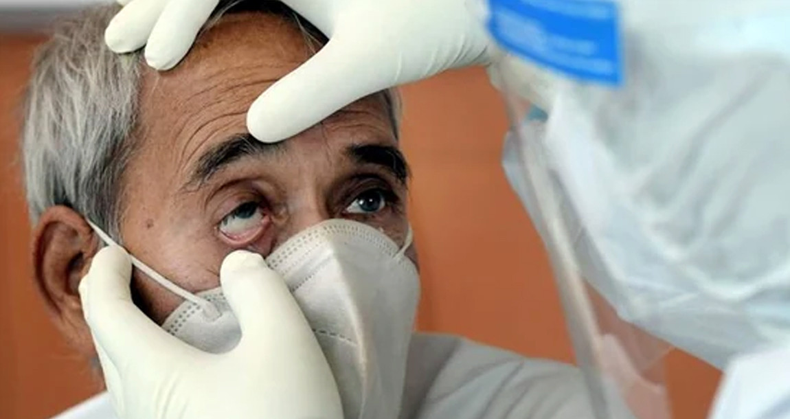 ‘प्राणघातक’ भएर आएको कालो ढुसीबाट कसरी जोगिने ? विज्ञको यस्तो सुझाव