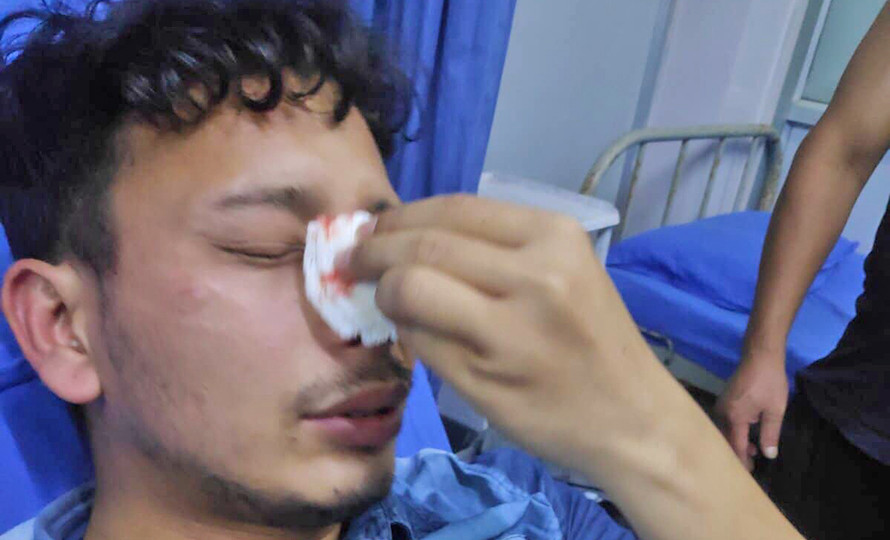 ड्युटीबाट फर्किएका चिकित्सकको नाकको डाँडी भाँचिदिने प्रहरी माथि भयो यस्तो कारबाही, खाँणको चौतर्फी प्रसंशा !